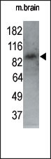 The anti-MARK1 N-term Pab (Cat. #AP7144a) is used in Western blot to detect MARK1 in P7 mouse whole brain lysate (60 ug). 1:250 dilution of anti-MARK1 pab was used. Data and protocol kindly provided by DR. Shengli Zhao, M.D., Ph.D. of Duke University Medical Center.