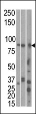 The anti-MARK1 C-term Pab (Cat. #7144b) is used in Western blot to detect MARK1 in, from left to right, Hela, T47D, and mouse brain cell line/ tissue lysate.