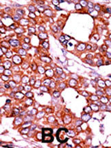 IHC-P - Phospho-CDC25A(T507) Antibody AP3051A