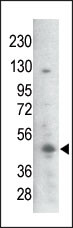 The anti-Phospho-GSK3B-S21/29 Pab (Cat. #AP3111a) is used in Western blot to detect Phospho-GSK3B-S21/29 in mouse thymus tissue lysate.