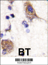 IHC-P - SCYL2 Antibody(C-term) AP7024b