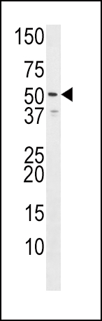 Western blot analysis of anti-HH3R Pab (Rabbit ID 1071) in Jurkat cell line lysate (35ug/lane). HH3R(arrow) was detected using the purified Pab. This western blot identifies isoform two of HRH3. The accession number of HRH3 is CAC39434; Q9Y5N1.