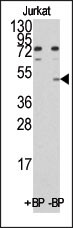 Western blot analysis of anti-MINA (C-term) Pab pre-incubated with and without blocking peptide (BP)(catlog #:BP1033b) in Jurkat cell line lysate. MINA(C-term)(arrow) was detected using the purified Pab.