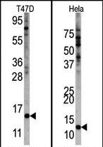 Western blot analysis of anti-FUBI Center Pab (AP1600c) in Hela and T47D cell line lysates. FUBI Center(arrow) was detected using the purified Pab.