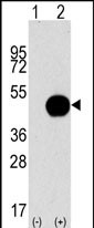 Western blot analysis of APG4B (arrow) using purified Pab (Cat.#AP1809d). 293 cell lysates (2 ug/lane) either nontransfected (Lane 1) or transiently transfected with the APG4B gene (Lane 2) (Origene Technologies).