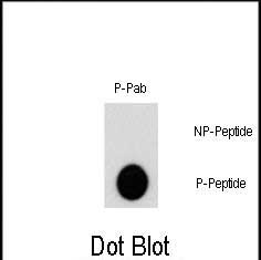 Dot blot analysis of Phospho-AKT2-S474 polyclonal antibody (Cat# AP3337a) on nitrocellulose membrane. 50ng of Phospho-peptide or Non Phospho-peptide per dot were adsorbed. Antibody working concentration was 0.5ug per ml. P-Pab: phospho-antibody; P-Peptide: phospho-peptide; NP-Peptide: non-phospho-peptide.