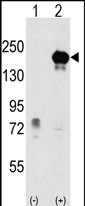 Western blot analysis of EHMT1 (arrow) using rabbit polyclonal EHMT1 Antibody (Center)(Cat.#AP1018c). 293 cell lysates (2 ug/lane) either nontransfected (Lane 1) or transiently transfected with the EHMT1 gene (Lane 2) (Origene Technologies).