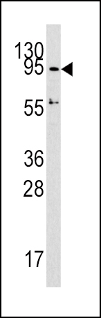 Western blot analysis of DNMT3A Antibody (C-term) (Cat.# AP1023b) in HepG2 cell line lysates (35ug/lane). DNMT3A (arrow) was detected using the purified Pab.