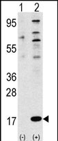 Western blot analysis of FUBI Antibody (N-term) polyclonal antibody(Cat.#AP1600a)(arrow). 293 cell lysates (2 ug/lane) either nontransfected (Lane 1) or transiently transfected with the FUBI gene (Lane 2) (Origene Technologies).