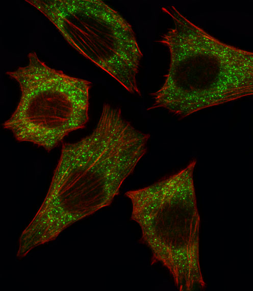 Fluorescent image of C2C12 cell stained with BRAF Antibody (Center)(Cat#AP7810c).C2C12 cells were fixed with 4% PFA (20 min), permeabilized with Triton X-100 (0.1%, 10 min), then incubated with BRAF primary antibody (1:25, 1 h at 37?). For secondary antibody, Alexa Fluor� 488 conjugated donkey anti-rabbit antibody (green) was used (1:400, 50 min at 37?).Cytoplasmic actin was counterstained with Alexa Fluor� 555 (red) conjugated Phalloidin (7units/ml, 1 h at 37?).BRAF immunoreactivity is localized to Cytoplasm significantly.