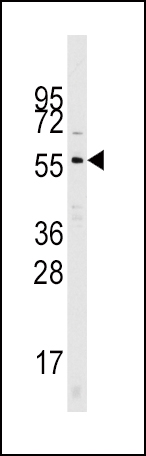 Western blot analysis of Cdc25A Pab (Cat# AP6272a) in mouse kidney tissue lysates (35ug/lane). Cdc25A (arrow) was detected using the purified Pab.