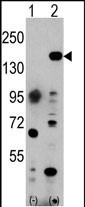 Western blot analysis of EHMT1 (arrow) using rabbit polyclonal EHMT1 Antibody (C-term) (Cat#AP1018b). 293 cell lysates (2 ug/lane) either nontransfected (Lane 1) or transiently transfected with the EHMT1 gene (Lane 2) (Origene Technologies).