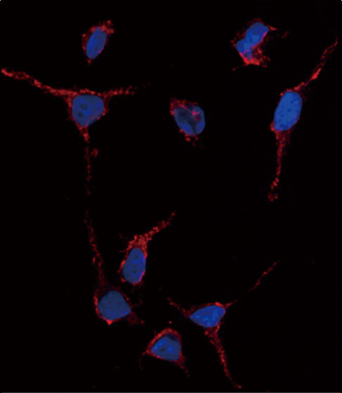 Immunofluorescence analysis of anti-ALDH1A1 Antibody (Center) in HeLa cells. 0.025 mg/ml primary antibody was followed by Alexa-Fluor-546-conjugated donkey anti-rabbit lgG (H+L). Alexa-Fluor-546 emits orange fluorescence. Blue counterstaining is DAPI.