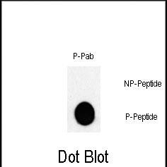 Dot blot analysis of Phospho-JUN-T243 Pab (Cat.AP3294a) on nitrocellulose membrane. 50ng of Phospho-peptide or Non Phospho-peptide per dot were adsorbed. Antibody working concentrations are 0.5ug per ml.