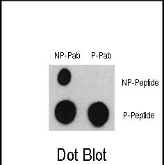 Dot blot analysis of Phospho-ATF2-S322 Antibody (Cat. #AP3372a) and ATF2 Non Phospho-specific Pab on nitrocellulose membrane. 50ng of Phospho-peptide or Non Phospho-peptide per dot were adsorbed. Antibody working concentrations are 0.5ug per ml.