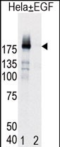 Western blot analysis of EGFR (arrow) in Hela cell lysates, either induced (Lane 1) or noninduced with EGF (Lane 2).