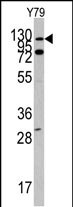 Western blot analysis of ABL1 Antibody (N-term H246) (Cat.#AP7694c) in Y79 cell line lysates (35ug/lane). ABL1(arrow) was detected using the purified Pab.