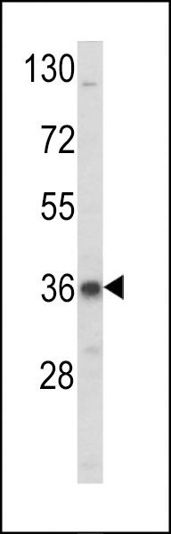 Western blot analysis of LDLRAP1 Antibody (N-term) (Cat. #AP8013a) in K562 cell line lysates (35ug/lane). LDLRAP1 (arrow) was detected using the purified Pab.
