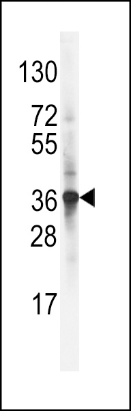 Western blot analysis of LDLRAP1 Antibody (C-term) (Cat.#AP8013b) in NCI-H460 cell line lysates (35ug/lane). LDLRAP1 (arrow) was detected using the purified Pab.
