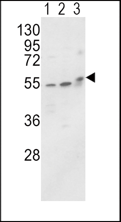 Western blot analysis of ALPL Antibody (N-term) (Cat. #AP1474a) in MCF-7(lane 1),HL-60 cell line(lane 2) and mouse brain tissue(lane 3) lysates (35ug/lane). ALPL (arrow) was detected using the purified Pab.