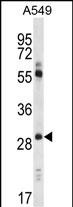 CLDN1 Antibody (Loop1) (Cat.#AP6308a) western blot analysis in A549 cell line lysates (35ug/lane).This demonstrates the CLDN1 antibody detected the CLDN1 protein (arrow).