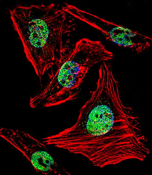 Fluorescent confocal image of Hela cell stained with ZBTB7B Antibody (C-term)(Cat#AP6370b).Hela cells were fixed with 4% PFA (20 min), permeabilized with Triton X-100 (0.1%, 10 min), then incubated with ZBTB7B primary antibody (1:25, 1 h at 37?). For secondary antibody, Alexa Fluor� 488 conjugated donkey anti-rabbit antibody (green) was used (1:400, 50 min at 37?).Cytoplasmic actin was counterstained with Alexa Fluor� 555 (red) conjugated Phalloidin (7units/ml, 1 h at 37?). Nuclei were counterstained with DAPI (blue) (10 �g/ml, 10 min). ZBTB7B immunoreactivity is localized to Nucleus significantly.