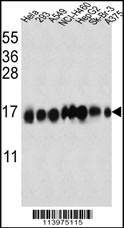 WB - Interferon-inducible protein (IFITM3) Antibody (N-term) AP1153a