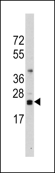 Western blot analysis of anti-CD3Z Antibody (N-term) (RB13817) in Ramos cell line lysates (35ug/lane). CD3Z(arrow) was detected using the purified Pab.