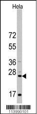 Western blot analysis of anti-CD8A Antibody (N-term) (Cat.#AP1414a) in Hela cell line lysates (35ug/lane). CD8A(arrow) was detected using the purified Pab.