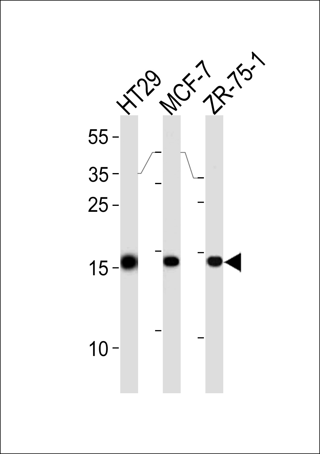 WB - AGR2 Antibody (Center) AP6279c