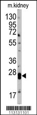 Western blot analysis of anti-hCLDN1-Loop2 Pab (Cat. #AP6308b) in mouse kidney tissue lysates (35ug/lane). CLDN1(arrow) was detected using the purified Pab.