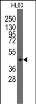 WB - Lmx1a Antibody (Center) AP1426c