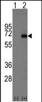 Western blot analysis of AFP (arrow) using rabbit polyclonal AFP  Antibody (Center) (Cat.#AP1430c). 293 cell lysates (2 ug/lane) either nontransfected (Lane 1) or transiently transfected with the AFP  gene (Lane 2) (Origene Technologies).