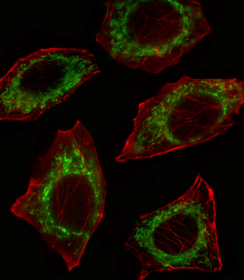 Fluorescent confocal image of A549 cell stained with ALDH2 Antibody (N-term)(Cat#AP1432a).A549 cells were fixed with 4% PFA (20 min), permeabilized with Triton X-100 (0.1%, 10 min), then incubated with ALDH2 primary antibody (1:25, 1 h at 37?). For secondary antibody, Alexa Fluor� 488 conjugated donkey anti-rabbit antibody (green) was used (1:400, 50 min at 37?).Cytoplasmic actin was counterstained with Alexa Fluor� 555 (red) conjugated Phalloidin (7units/ml, 1 h at 37?). Nuclei were counterstained with DAPI (blue) (10 �g/ml, 10 min).ALDH2 immunoreactivity is localized to Mitochondrion significantly.