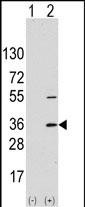 Western blot analysis of SSR1 (arrow) using rabbit SSR1 Antibody (N-term). 293 cell lysates (2 ug/lane) either nontransfected (Lane 1) or transiently transfected with the SSR1 gene (Lane 2) (Origene Technologies).