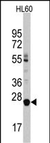 Western blot analysis of LIN28B Antibody (C-term) in HL60 cell line lysates (35ug/lane). LIN28B (arrow) was detected using the purified Pab.
