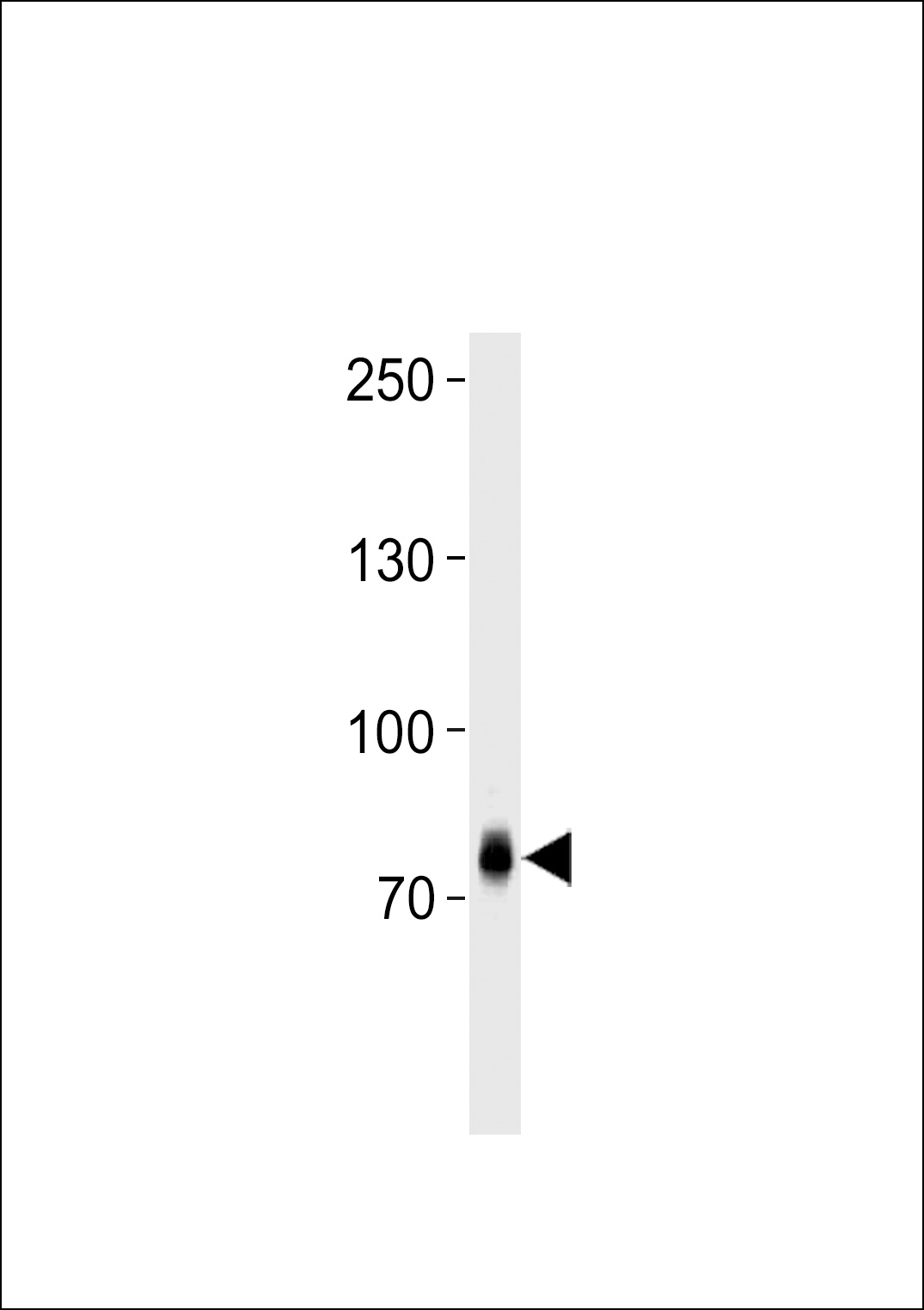 ZNF219 Antibody (C-term) (Cat. #AP1982b) western blot analysis in CEM cell line lysates (35ug/lane).This demonstrates the ZNF219 antibody detected the ZNF219 protein (arrow).