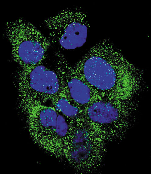 Confocal immunofluorescent analysis of Phospho-ABL-Y185 Antibody(Cat#AP3481a) with MCF-7 cell followed by Alexa Fluor 488-conjugated goat anti-rabbit lgG (green). DAPI was used to stain the cell nuclear (blue).