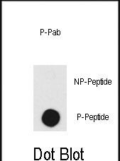 Dot blot analysis of anti-DNA-PK-pT2609 Pab (RB08113) on nitrocellulose membrane. 50ng of Phospho-peptide or Non Phospho-peptide per dot were adsorbed. Antibody working concentrations are 0.5ug per ml.