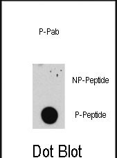 Dot blot analysis of anti-E2F1-pS332 Pab (RB08110) on nitrocellulose membrane. 50ng of Phospho-peptide or Non Phospho-peptide per dot were adsorbed. Antibody working concentrations are 0.5ug per ml.