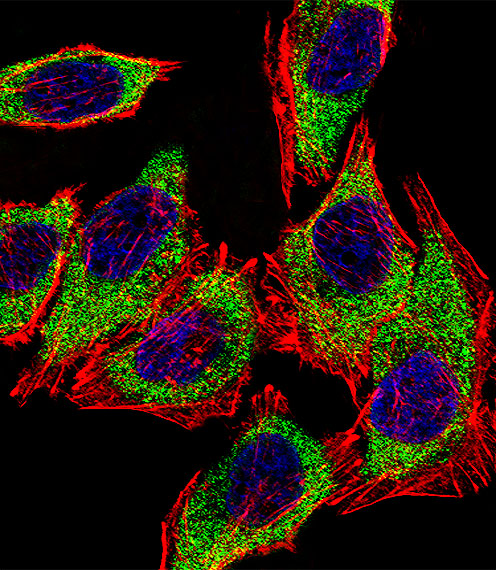 Fluorescent confocal image of A549 cell stained with AGR2 Antibody (N-term)(Cat#AP6279a).A549 cells were fixed with 4% PFA (20 min), permeabilized with Triton X-100 (0.1%, 10 min), then incubated with AGR2 primary antibody (1:25, 1 h at 37?). For secondary antibody, Alexa Fluor� 488 conjugated donkey anti-rabbit antibody (green) was used (1:400, 50 min at 37?).Cytoplasmic actin was counterstained with Alexa Fluor� 555 (red) conjugated Phalloidin (7units/ml, 1 h at 37?). Nuclei were counterstained with DAPI (blue) (10 �g/ml, 10 min). AGR2 immunoreactivity is localized to Cytoplasm significantly.