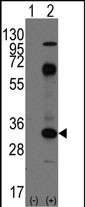 Western blot analysis of CD8A(arrow) using rabbit polyclonal CD8A Antibody (C-term) (Cat.#AP1414b). 293 cell lysates (2 ug/lane) either nontransfected (Lane 1) or transiently transfected with the CD8A gene (Lane 2) (Origene Technologies).