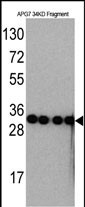 Western blot analysis of anti-APG7 Monoclonal Antibody (Cat.#AM1813a) by Recombinant APG7 protein (Fragment 34KD). APG7 protein (Fragment 34KD)(arrow) was detected using the ascites Mab.