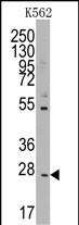 Western blot analysis of anti-CD8B1 Pab (Cat.#AP1440a) in K562 cell line lysates (35ug/lane). CD8B1(arrow) was detected using the purified Pab.