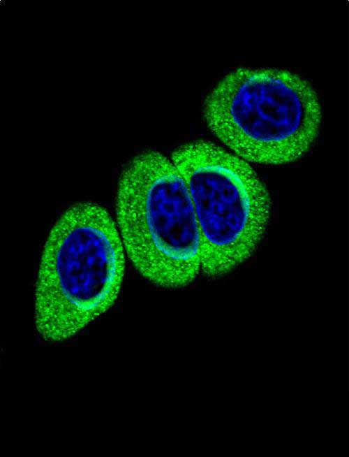 Confocal immunofluorescent analysis ofPhospho-ATM-pS1981 Antibody (Cat#AP3504a) with Hela cell followed by Alexa Fluor 488-conjugated goat anti-rabbit lgG (green). DAPI was used to stain the cell nuclear (blue).