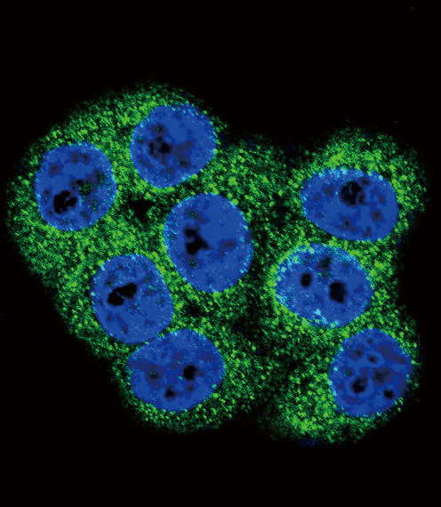 Confocal immunofluorescent analysis of DDR1 Antibody (Center)(Cat#AP7294c) with 293 cell followed by Alexa Fluor 488-conjugated goat anti-rabbit lgG (green).DAPI was used to stain the cell nuclear (blue).