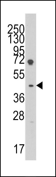 Western blot analysis of anti-LEFTB(C-term) Pab (Cat.#AP7297b) in HL60 cell line lysates (35ug/lane). LEFTB(arrow) was detected using the purified Pab.