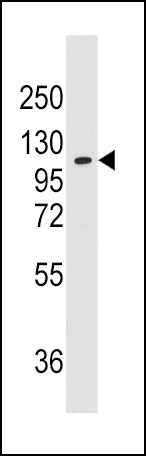 WB - AlaRS (AARS) Antibody (N-term) AP7558a