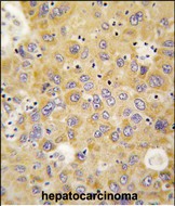 IHC-P - AlaRS (AARS) Antibody (N-term) AP7558a