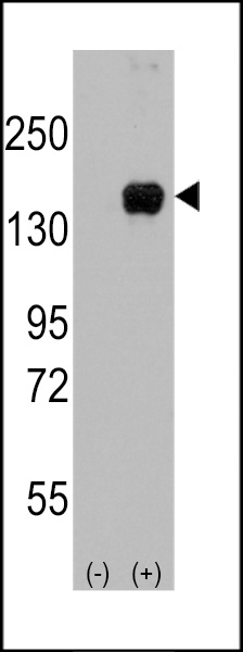 Western blot analysis of MAP3K5 (arrow) using rabbit polyclonal MAP3K5 Antibody (Cat.#AP7911f).293 cell lysates (2 ug/lane) either nontransfected (Lane 1) or transiently transfected with the MAP3K5 gene (Lane 2) (Origene Technologies).